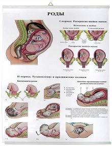 Роды (85х60 см)