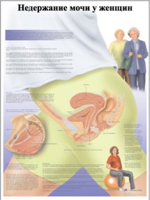 ZVR6542L Недержание мочи у женщин