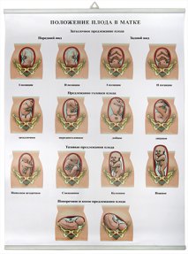 Положение плода в матке (85х60 см)